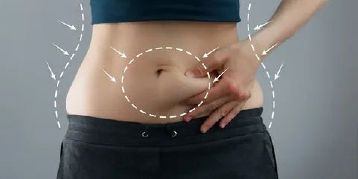 Achieve a Sculpted Figure with Liposuction in Islamabad