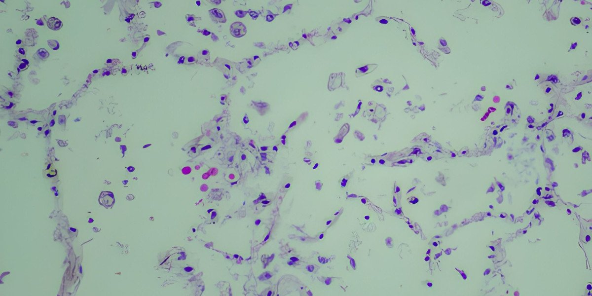 Cryptococcosis: Rising Challenges and Market Opportunities in Healthcare